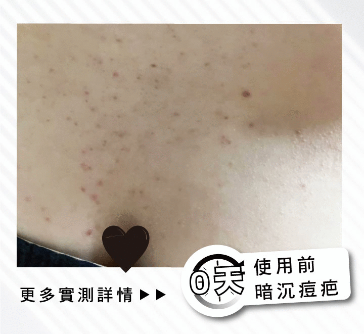 【限量買1送1】【趁秋冬全身白回來】逆黑瓷肌穀物精華液35ml (到期日2026.11.01) 10 6