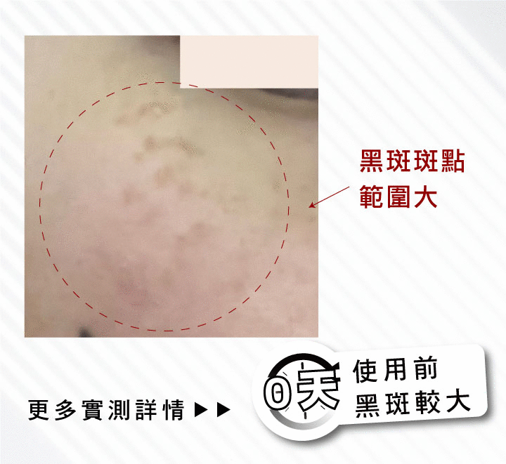 【限量買1送1】【趁秋冬全身白回來】逆黑瓷肌穀物精華液35ml (到期日2026.11.01) 12 8