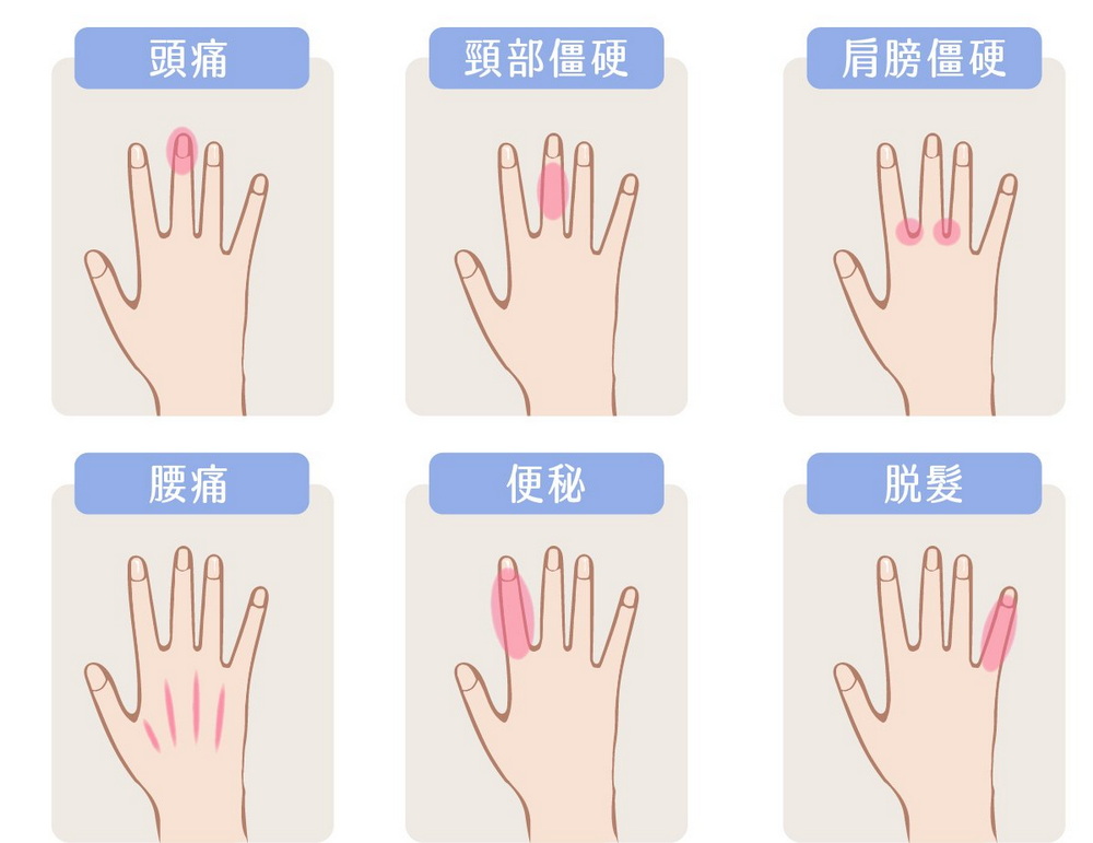 頭痛頸部僵硬肩膀僵硬腰痛便秘脫髮