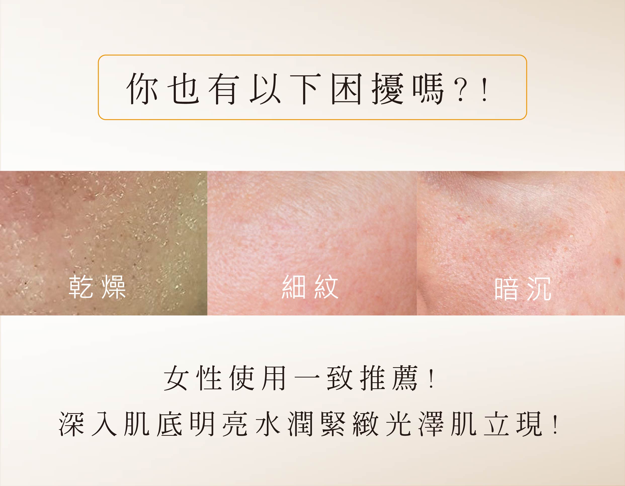 艾地苯全效精華|旅行瓶5g 6 乾燥、細紋、暗沉肌膚問題很困擾嗎?艾地苯全效精華超高滋潤使肌膚發亮緊實 - VIYA'S薇亞絲專業保養品