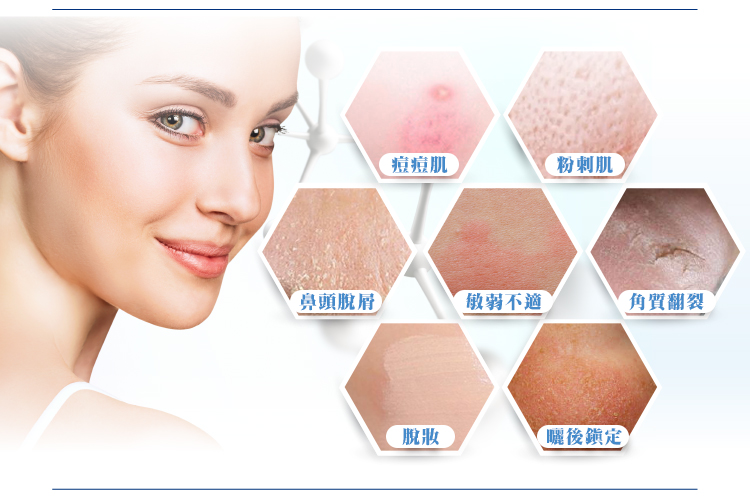 Vanicream薇霓肌本無油安膚清爽調理乳液,乳液,控油,清爽,無添加,無油,保濕,控油,痘,粉刺,受損,敏弱,肌膚,油性肌,混合肌,嬰幼兒,妊娠保養,無負擔,防護隔離,雞皮粒,曬後修護,四季保養,不黏膩,好吸收,脂漏性皮膚炎,尿布疹,濕疹,有效,推薦,會呼吸的乳液,清爽乳液,皮膚科醫師推薦,醫美級保養品,百大網紅推薦,粉刺,痘痘,缺水,乾燥,凡士林,粗糙,出油,毛孔粗大,保濕,脫屑,脫皮,皮膚炎,濕疹,抗過敏,消炎,退紅,止癢,異位性,脂漏性,敏感肌,保養品,無添加,母嬰用品,美國原裝進口,醫師推薦,國際認證,臨床研究,醫美,網友熱搜,熱銷排行,口碑推薦,評價,體驗,實測,開箱