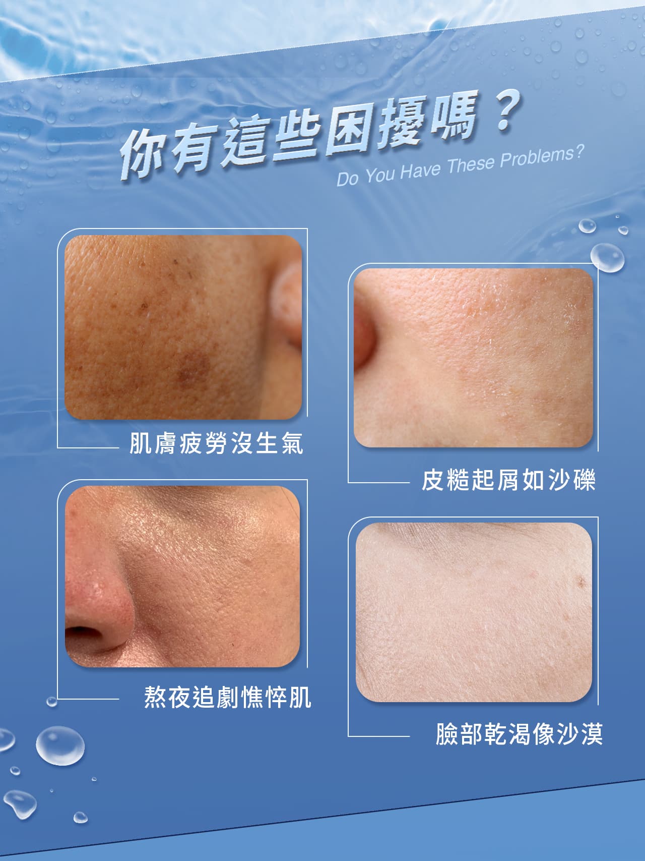 如果你有肌膚疲勞、皮膚起屑如沙礫、熬夜憔悴肌、臉部乾渴以上膚況，注意肌膚警訊！上妝不服貼外讓肌膚加速老化，讓文森先生來幫你！